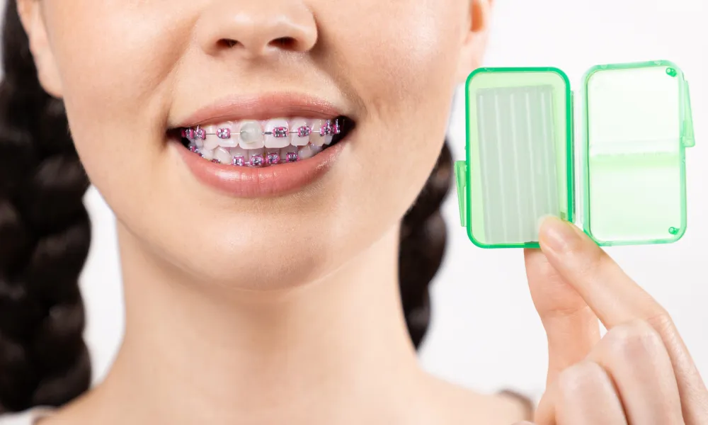 person with braces holding orthodontic wax case for braces care Pembroke Pines FL